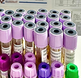 Complete Blood Count (CBC) at Vet Central Lab Philippines